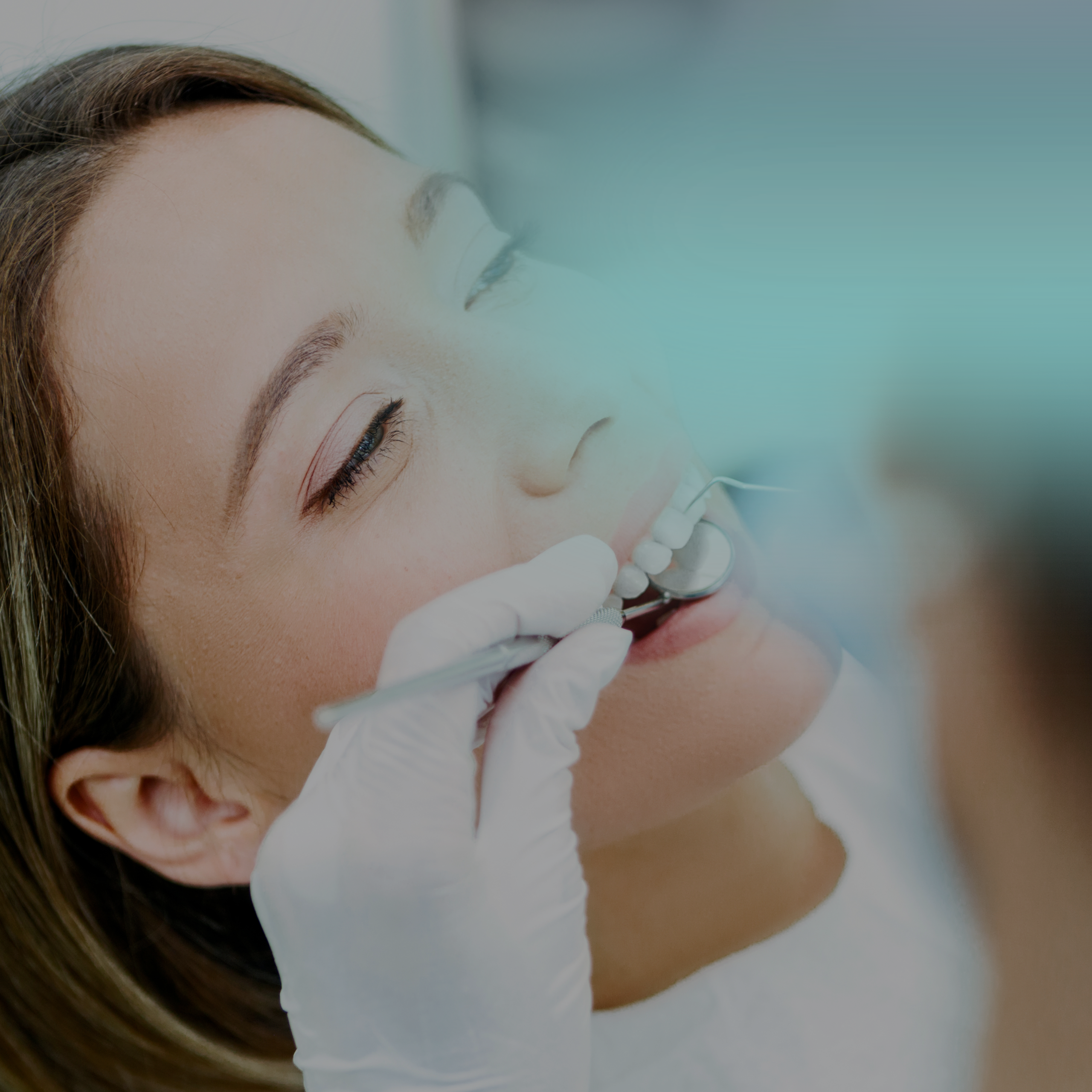 Packs carillas dentales de cerámica indirecta - Imagen 5