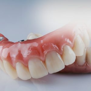 Packs carillas dentales de resina directa