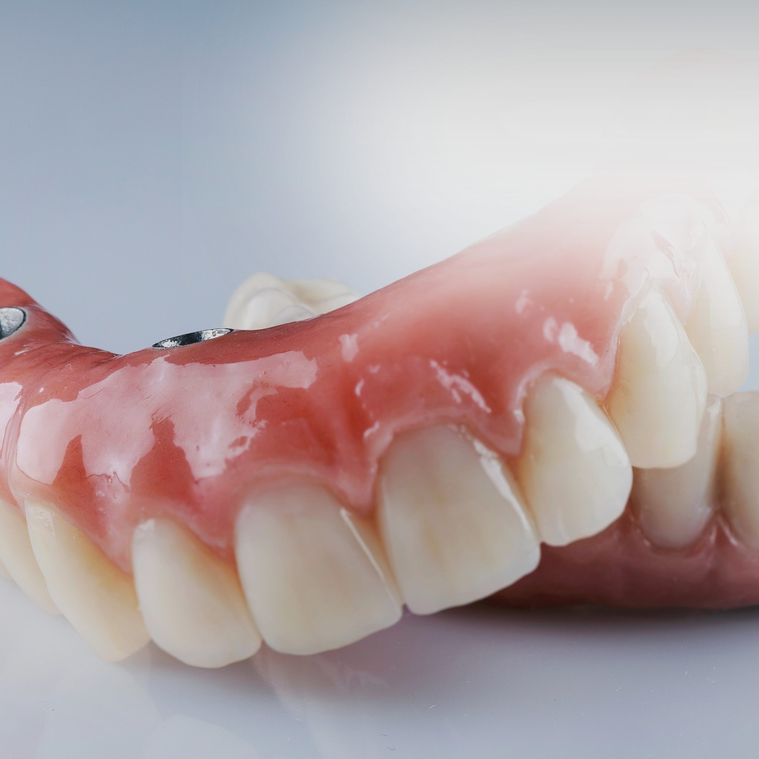 Packs carillas dentales de resina directa