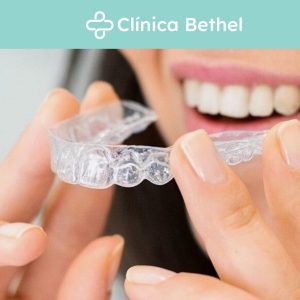 Carilla unitaria resina directa