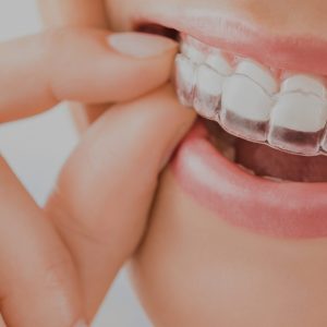 Limpieza Dental anti sensibilidad